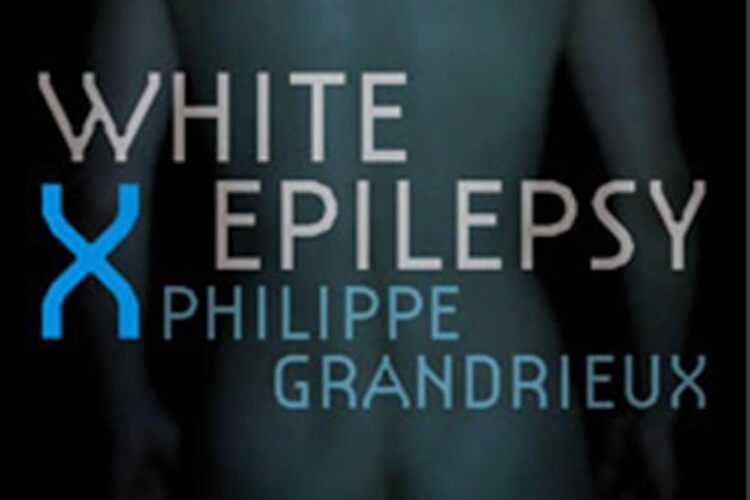 WHITE EPILEPSY