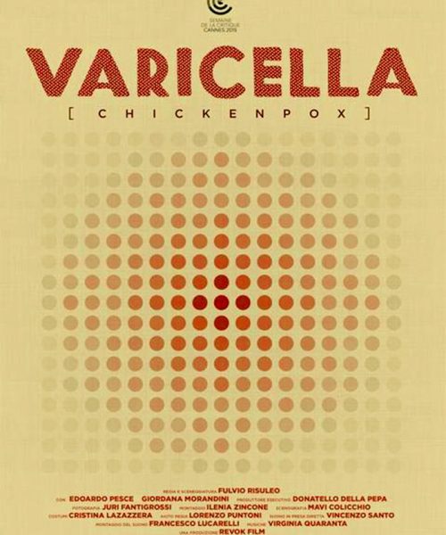 VARICELLA